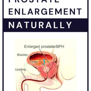 Treat Prostate Enlargement Naturally